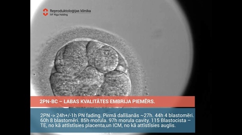 2PN BC - an example of a good quality embryo