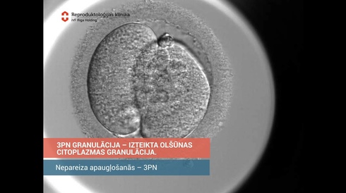 Incorrect fertilization - 3PN granulation