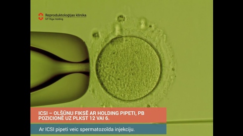 ICSI manipulation in the iVF Riga Embryolab