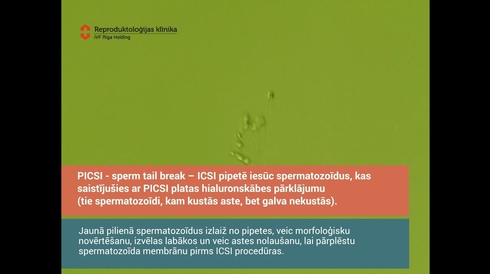 PICSI - Sperm tail break_iVF Riga Embryolab 